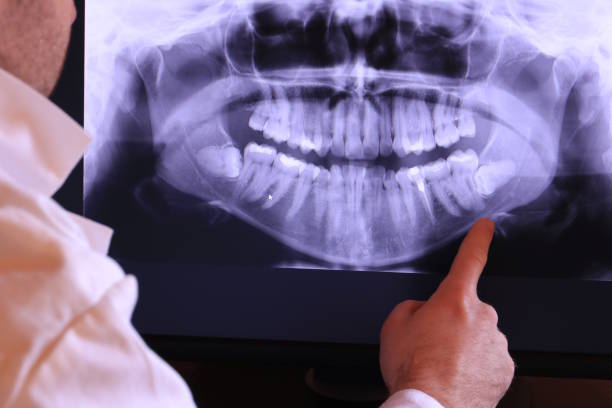 Best Emergency Dental Care for Trauma or Injury in Espaola, NM